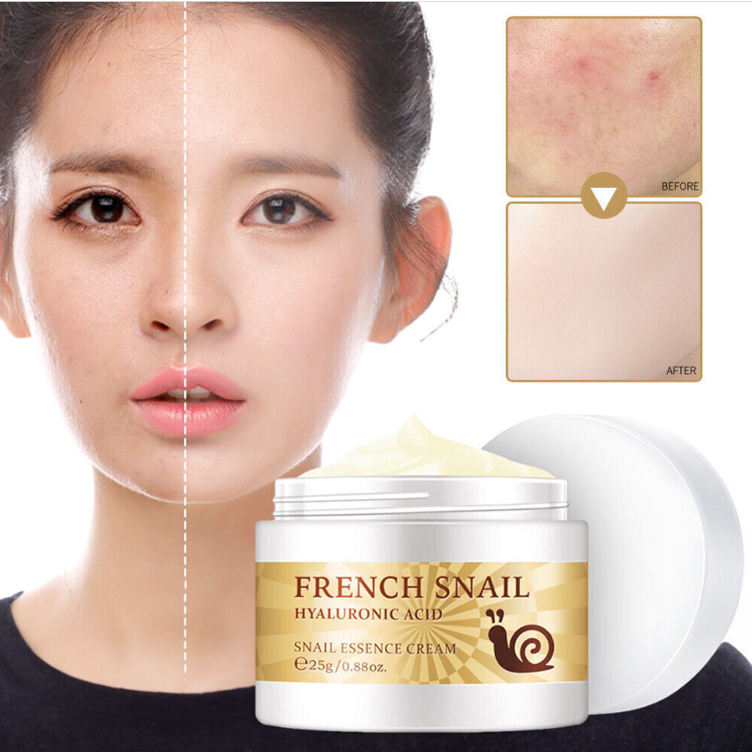 French Snail Face Cream Hyaluronic Acid Anti Wrinkle Anti Aging Collagen Cream==